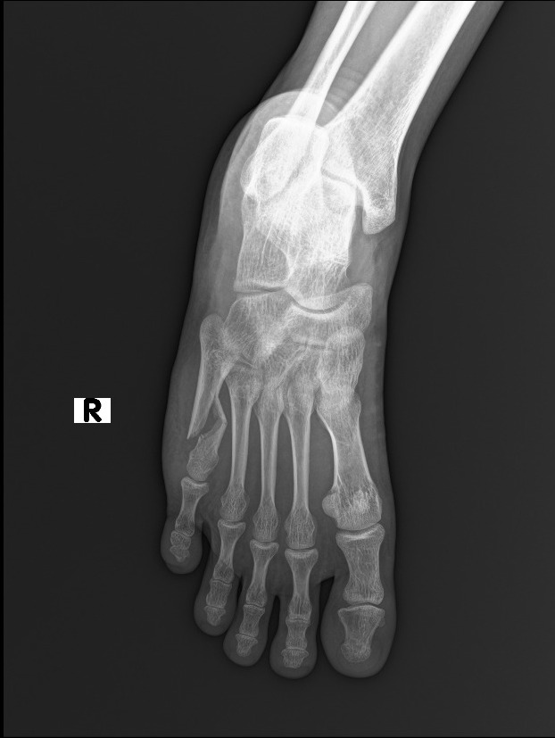 X-ray front view