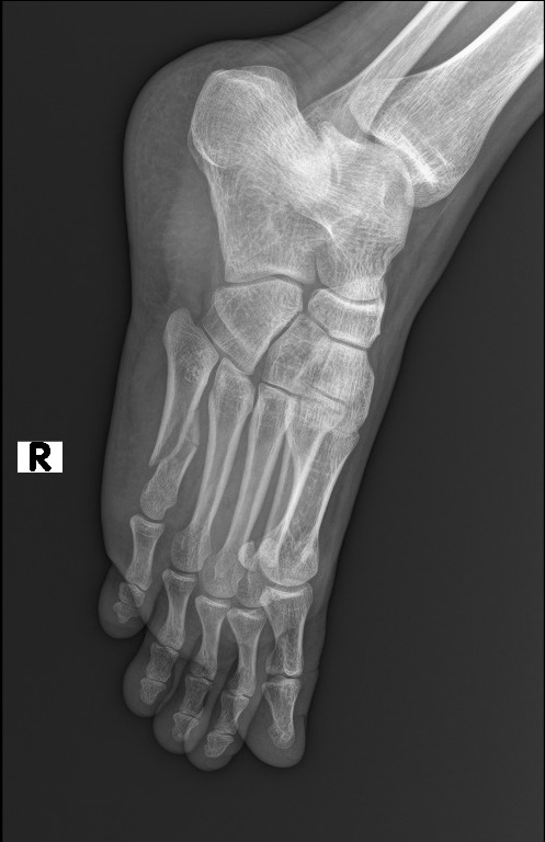 X-ray side view